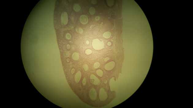 Ovary Graafian Follicle Slides - Ovary Graafian Follicle 003 100X